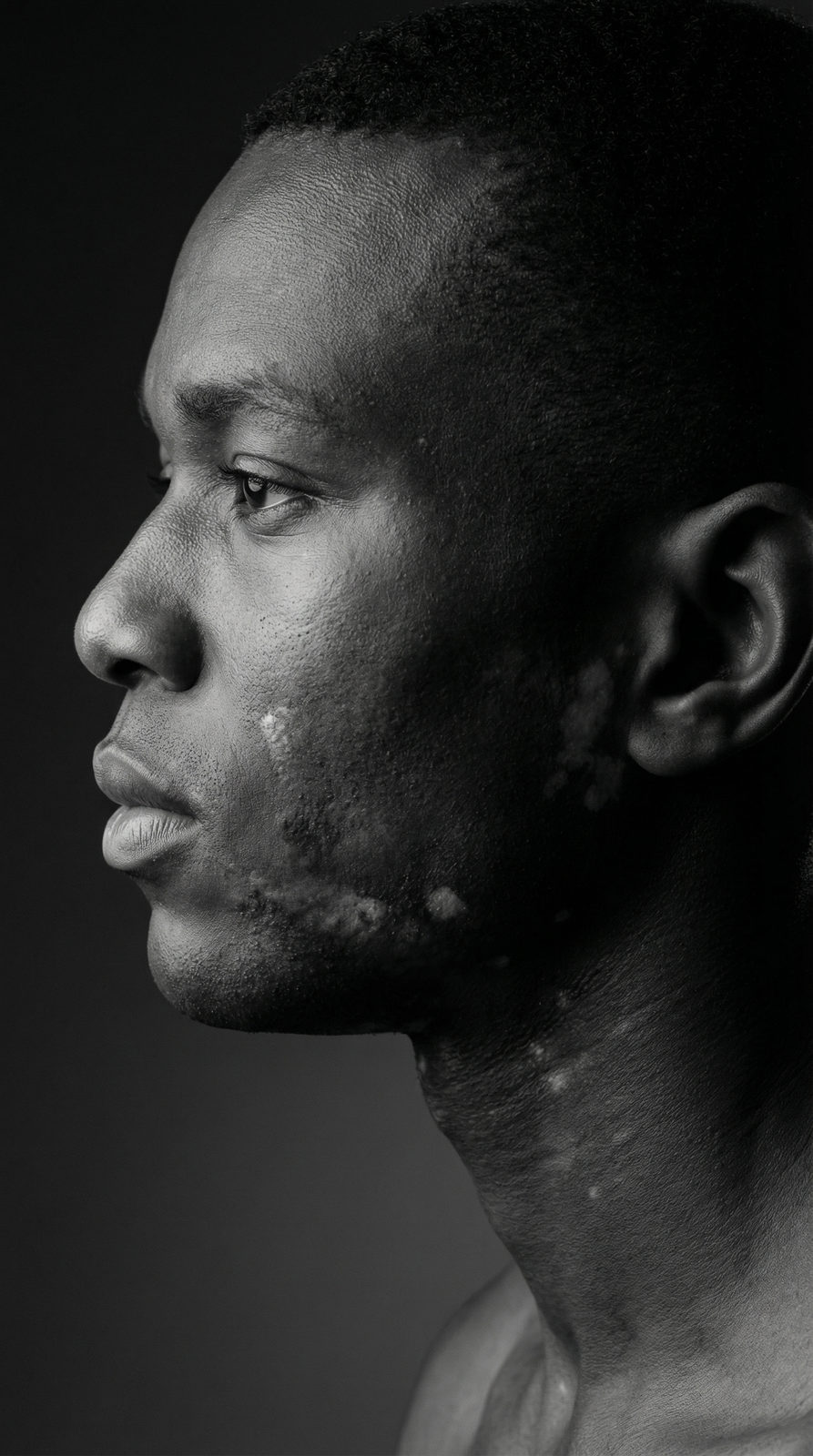 Ultra-realistic studio portrait of a person with natural vitiligo skin patterns, captured in a dramatic side-profile against a dark background.