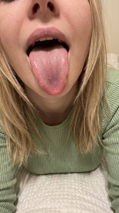 Close-up of a pale pink tongue with dark patches near the base, revealing part of the upper teeth, set against a soft, off-white background.